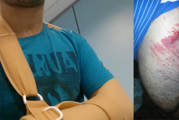 Un ciclista de Elorrio resulta herido con un cable-trampa en una pista próxima a Kanpazar