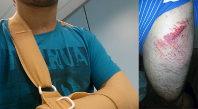 Un ciclista de Elorrio resulta herido con un cable-trampa en una pista próxima a Kanpazar